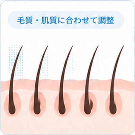毛質や肌質に合わせて医療レーザーの照射を調整するイメージ