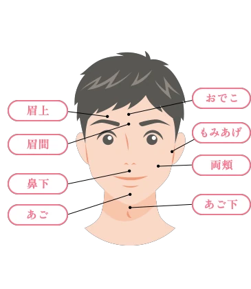 山口でジェントルマックスプロプラスを導入し、メンズ医療脱毛（ヒゲ脱毛）を提供している あんの循環器・総合クリニックの顔全体の対象部位イラスト