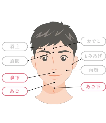山口でジェントルマックスプロプラスを導入し、メンズ医療脱毛（ヒゲ脱毛）を提供している あんの循環器・総合クリニックのヒゲ脱毛ライトの対象部位イラスト