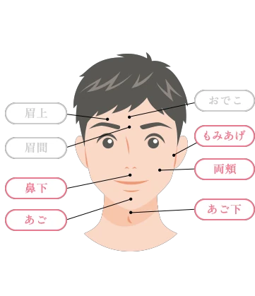 山口でジェントルマックスプロプラスを導入し、メンズ医療脱毛（ヒゲ脱毛）を提供している あんの循環器・総合クリニックのヒゲ脱毛スタンダードの対象部位イラスト