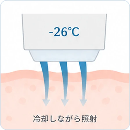 山口でジェントルマックスプロプラスを導入し、メンズ医療脱毛（ヒゲ脱毛）を提供している あんの循環器・総合クリニックの冷却システムの説明図